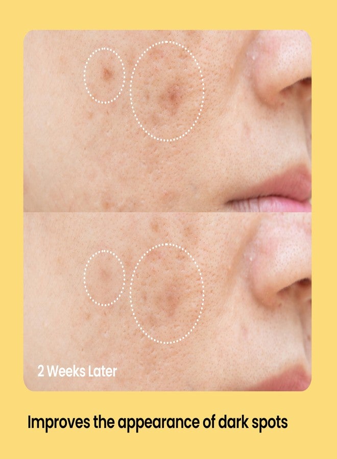 AVARELLE Dark Spot Patches (9 CT) | Dark Spot Acne for Face & Body with Vitamin C | Pimple Patches for Post-blemish Skin Care with Niacinamide, Tranexamic Acid, & Kojic Acid - Image 2
